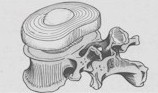 entrainer disque intervertebral